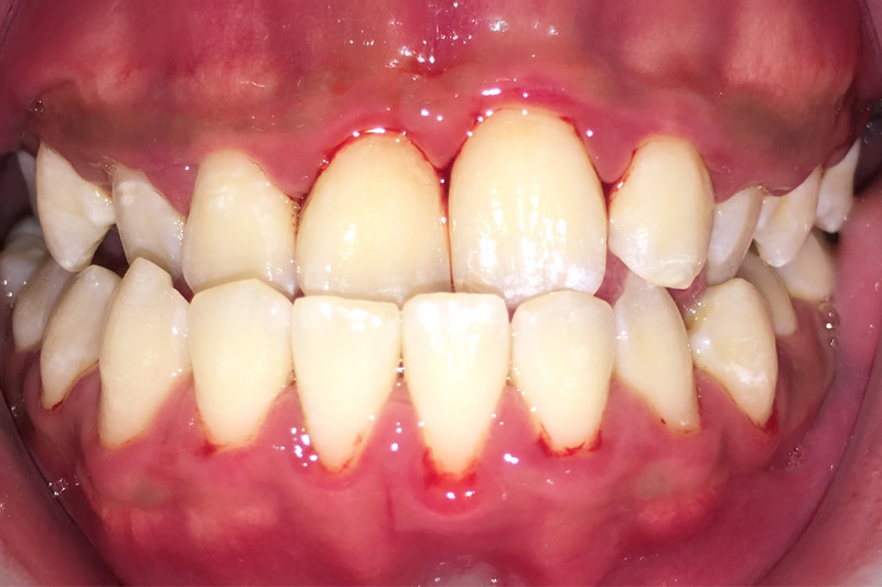 Before